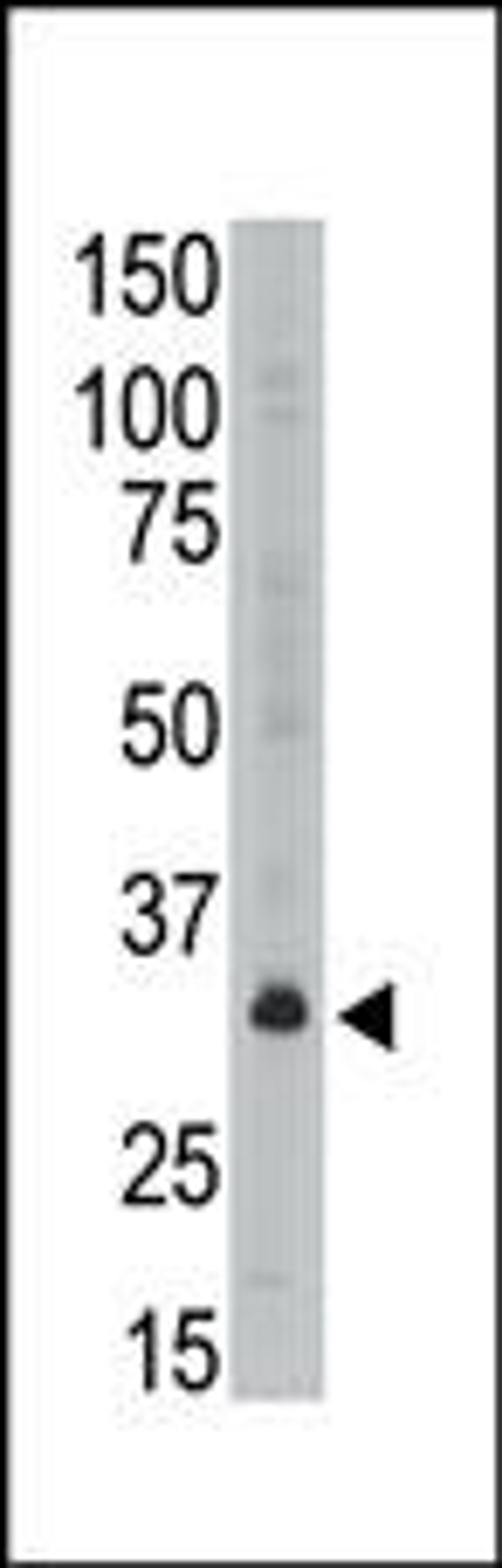 Antibody is used in Western blot to detect MAGEA6 in A549 lysate.