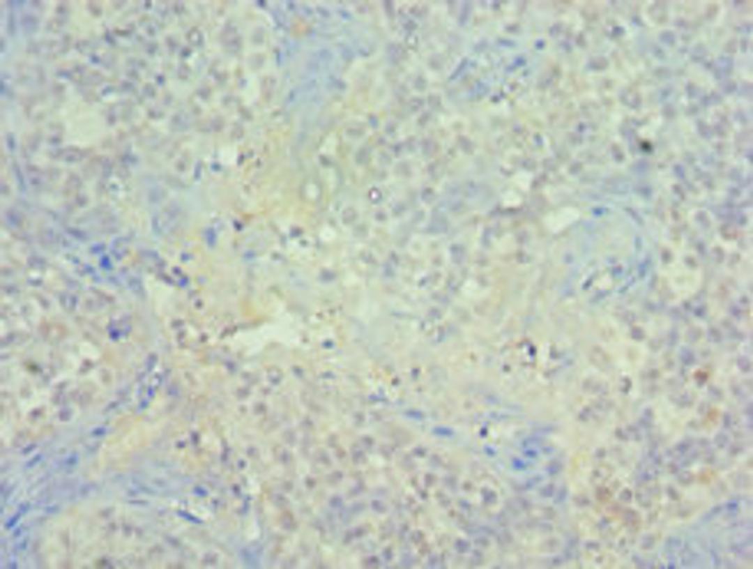 Immunohistochemistry of paraffin-embedded human tonsil tissue using CSB-PA017957ESR1HU at dilution of 1:100