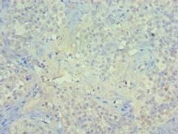 Immunohistochemistry of paraffin-embedded human tonsil tissue using CSB-PA017957ESR1HU at dilution of 1:100
