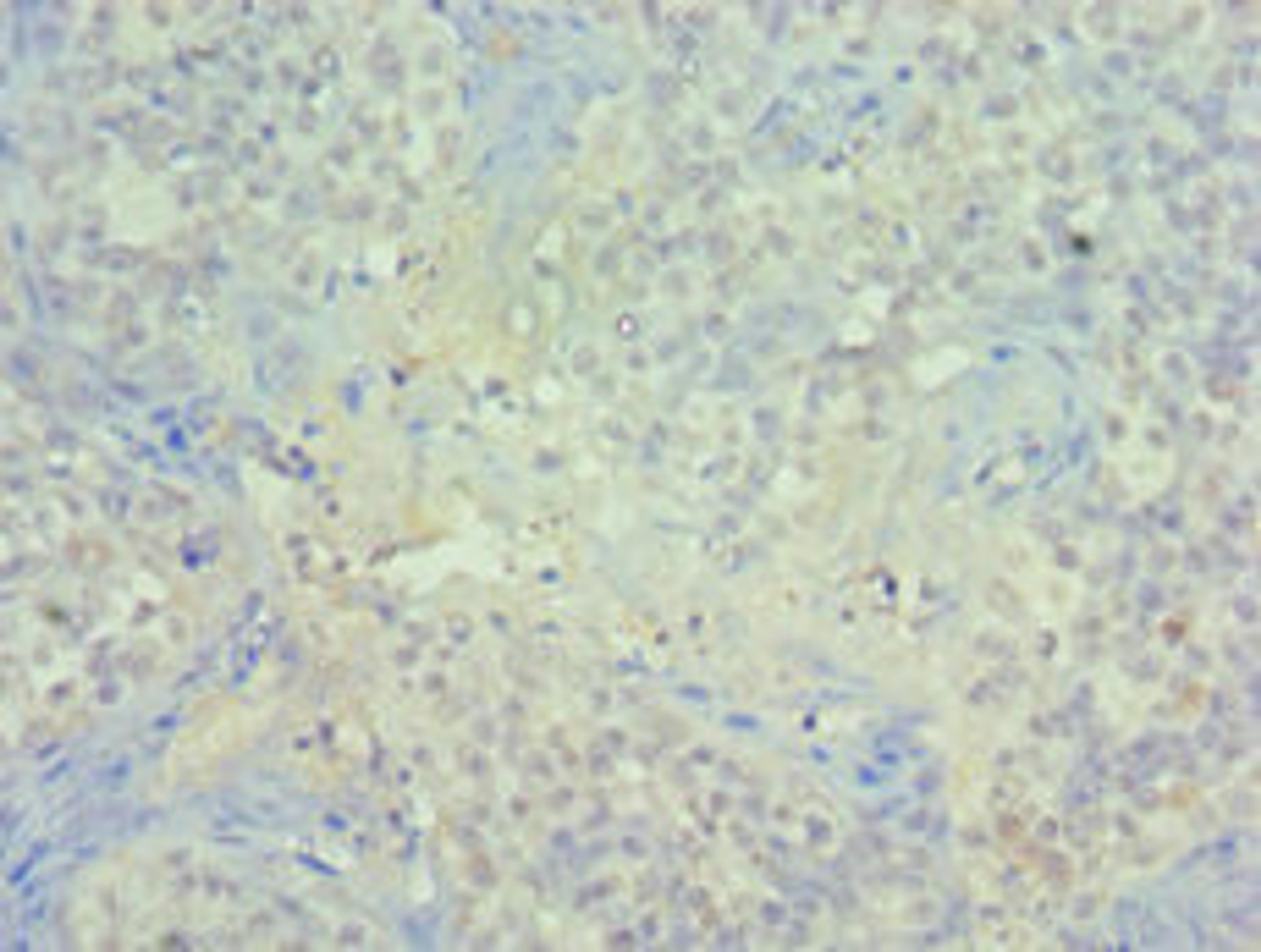 Immunohistochemistry of paraffin-embedded human tonsil tissue using CSB-PA017957ESR1HU at dilution of 1:100