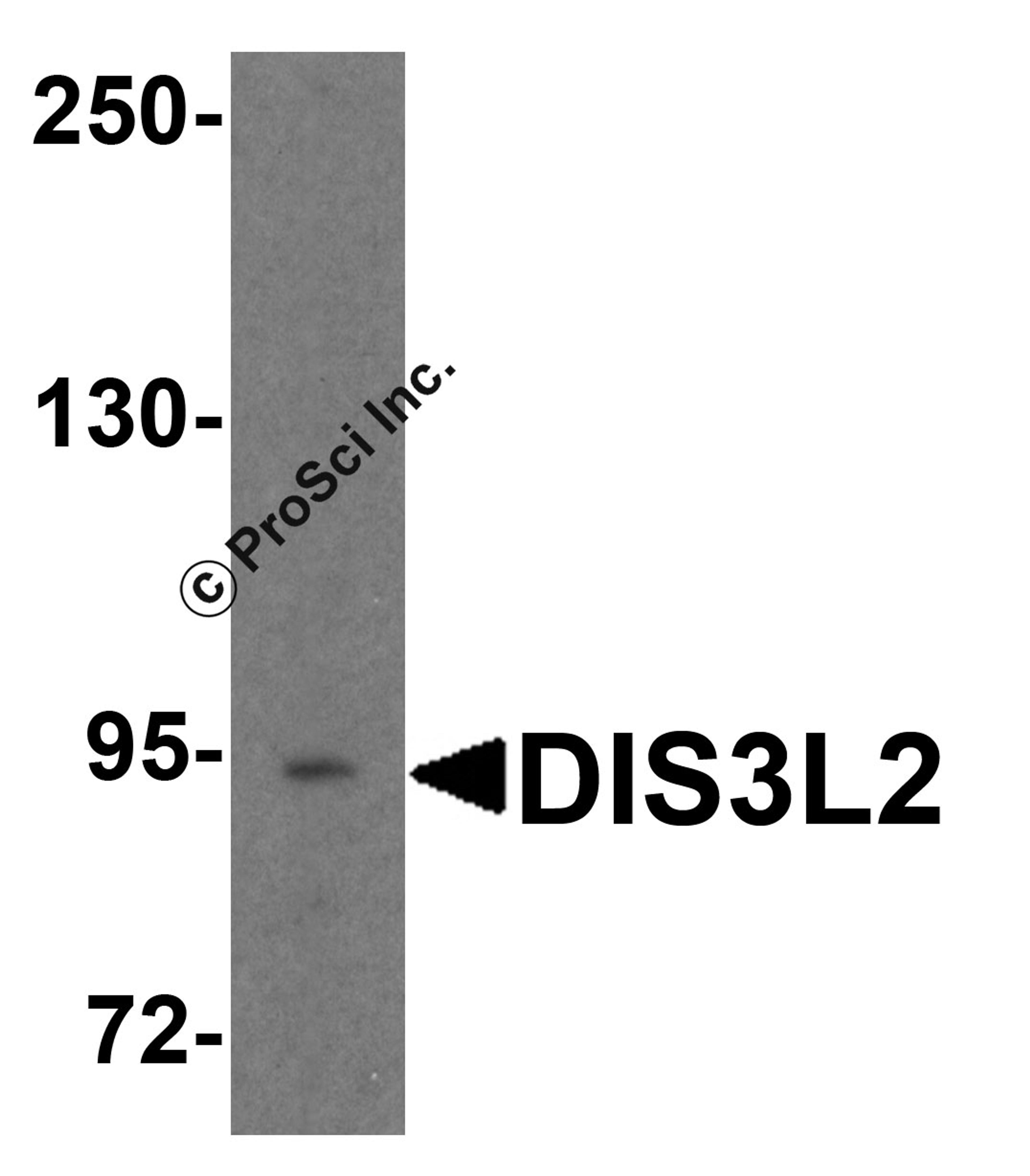 Western blot analysis of DIS3L2 in 3T3 cell lysate with DIS3L2 antibody at 1 μg/ml.