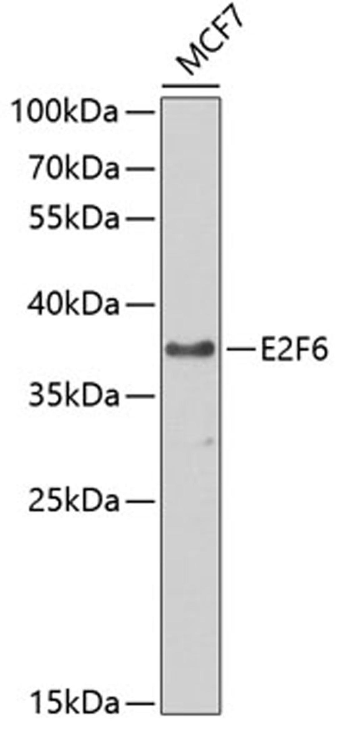 Western blot - E2F6 antibody (A2718)