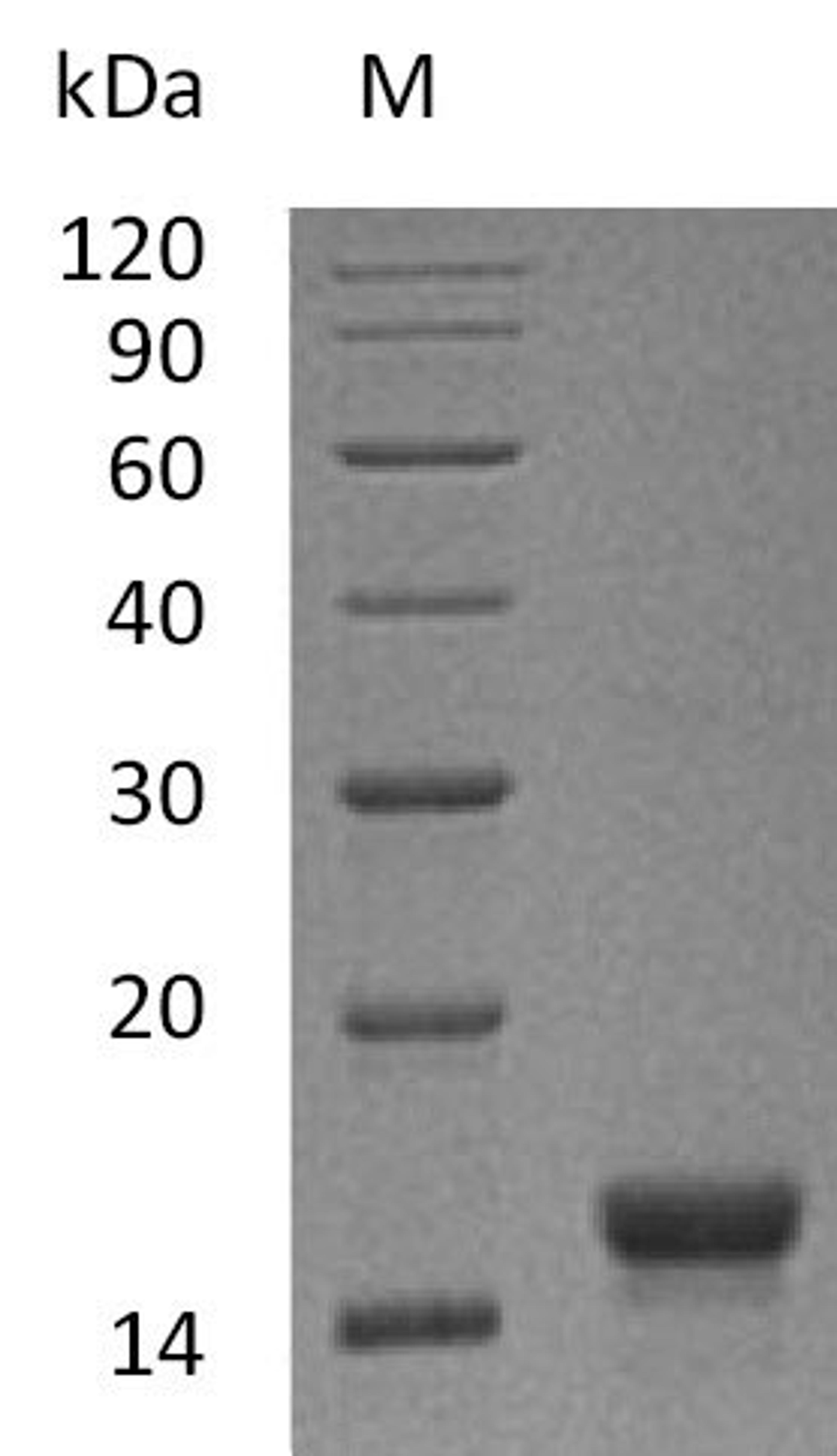 (Tris-Glycine gel) Discontinuous SDS-PAGE (reduced) with 5% enrichment gel and 15% separation gel.