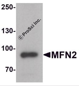 Western blot analysis of MFN2 in human brain tissue lysate with MFN2 antibody at 1 &#956;g/ml.