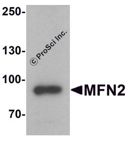 Western blot analysis of MFN2 in human brain tissue lysate with MFN2 antibody at 1 μg/ml.
