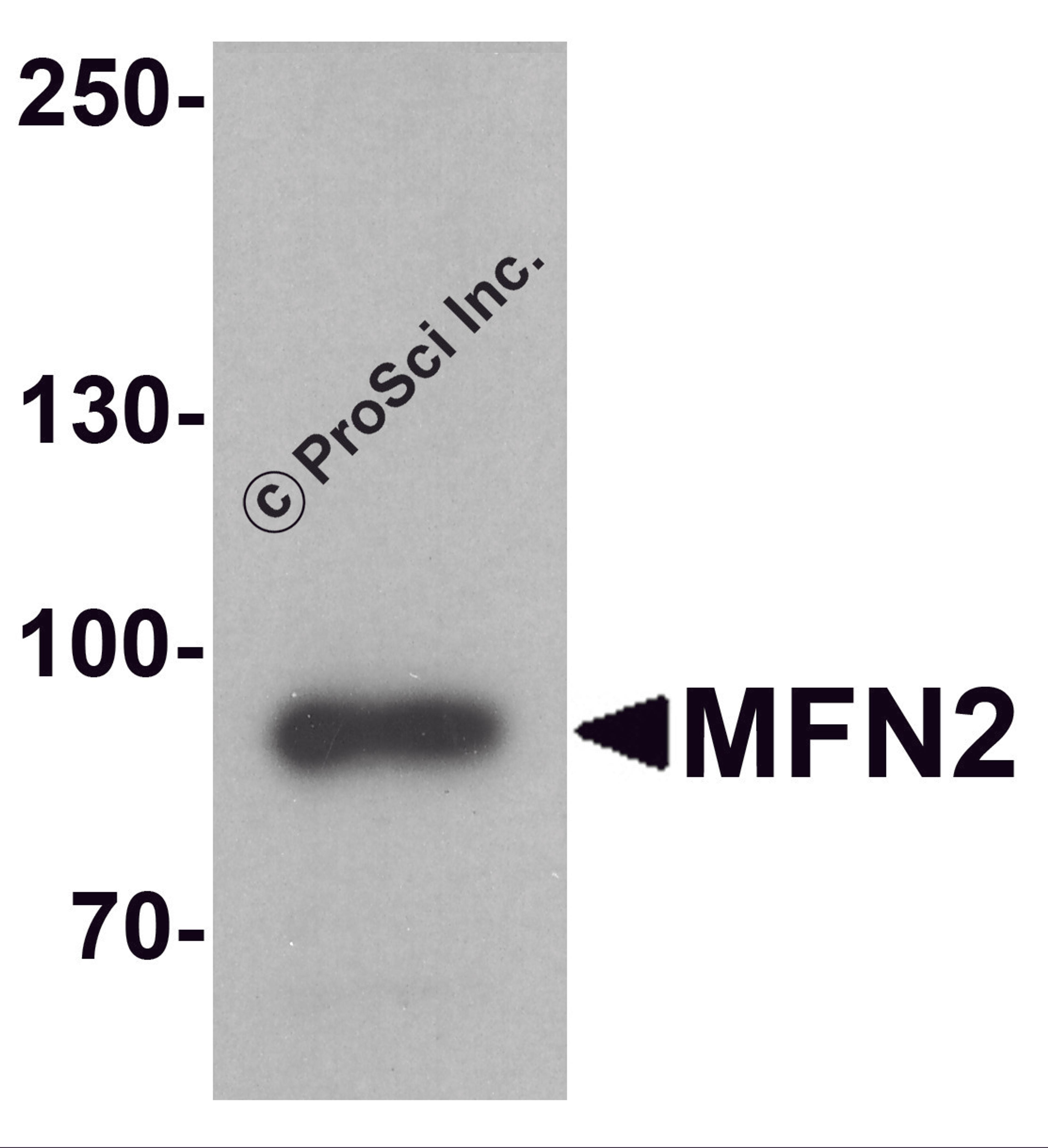 Western blot analysis of MFN2 in human brain tissue lysate with MFN2 antibody at 1 μg/ml.