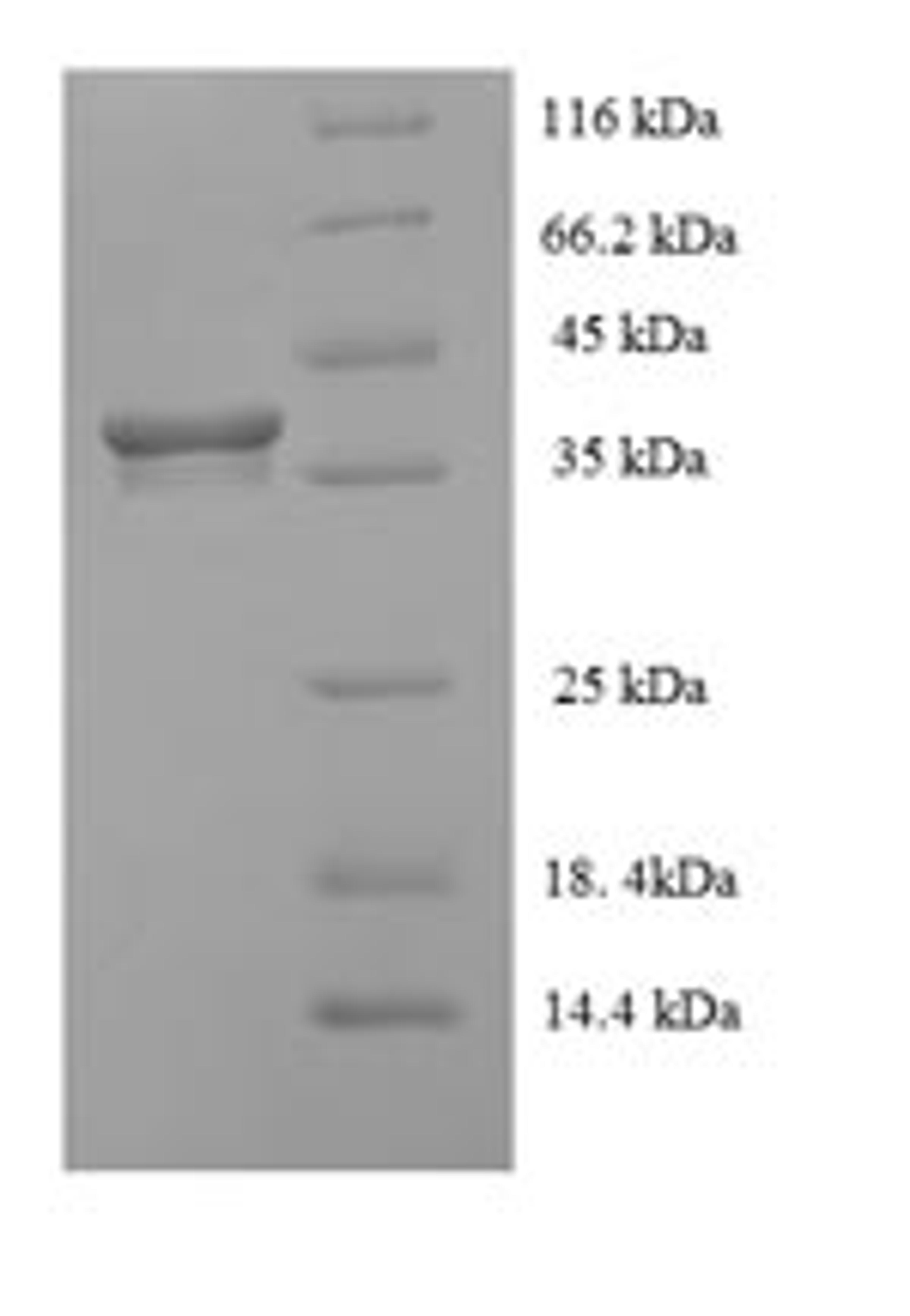 (Tris-Glycine gel) Discontinuous SDS-PAGE (reduced) with 5% enrichment gel and 15% separation gel.