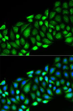 Immunofluorescence - RIPK2 antibody (A13381)