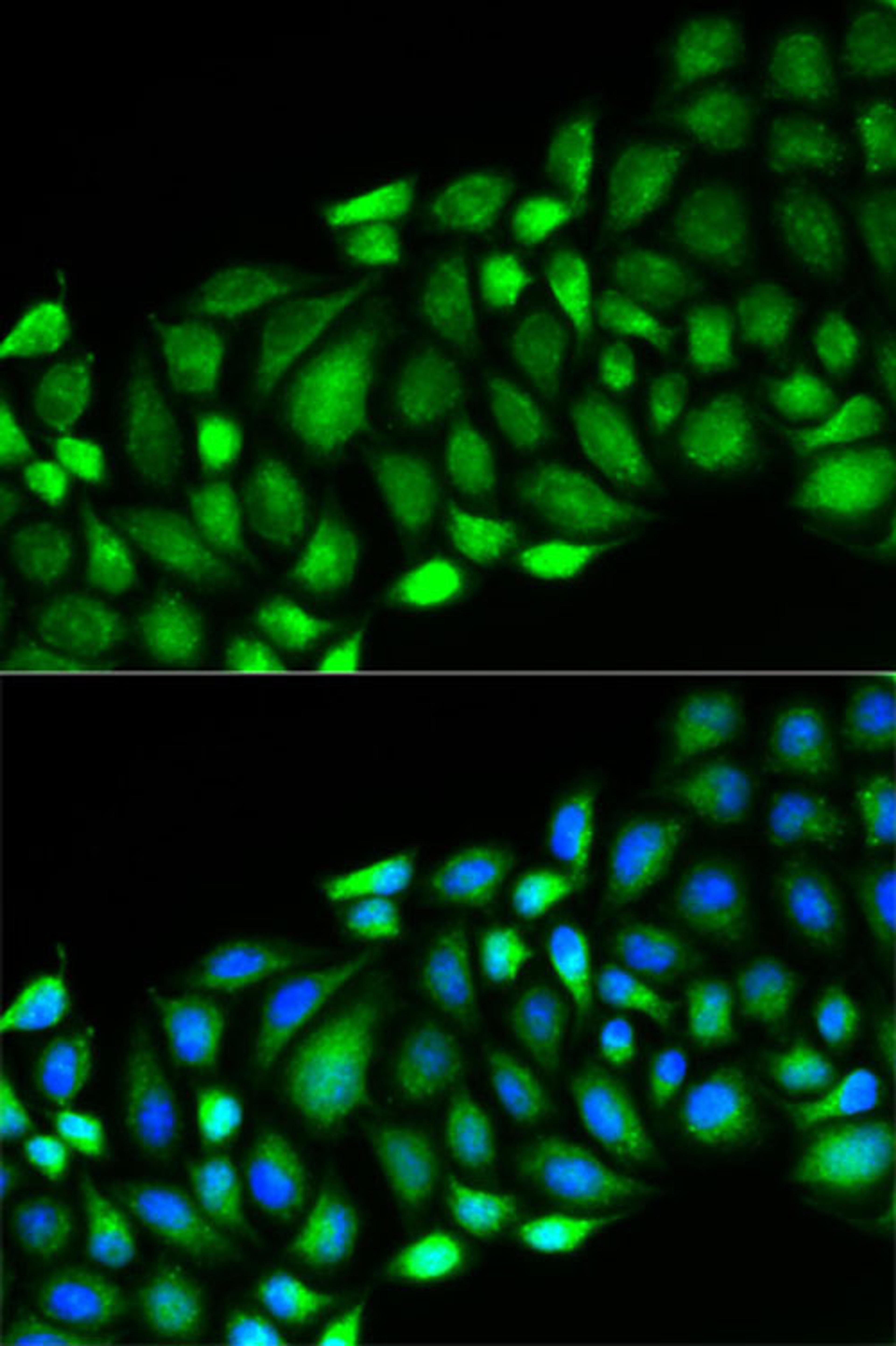 Immunofluorescence - RIPK2 antibody (A13381)