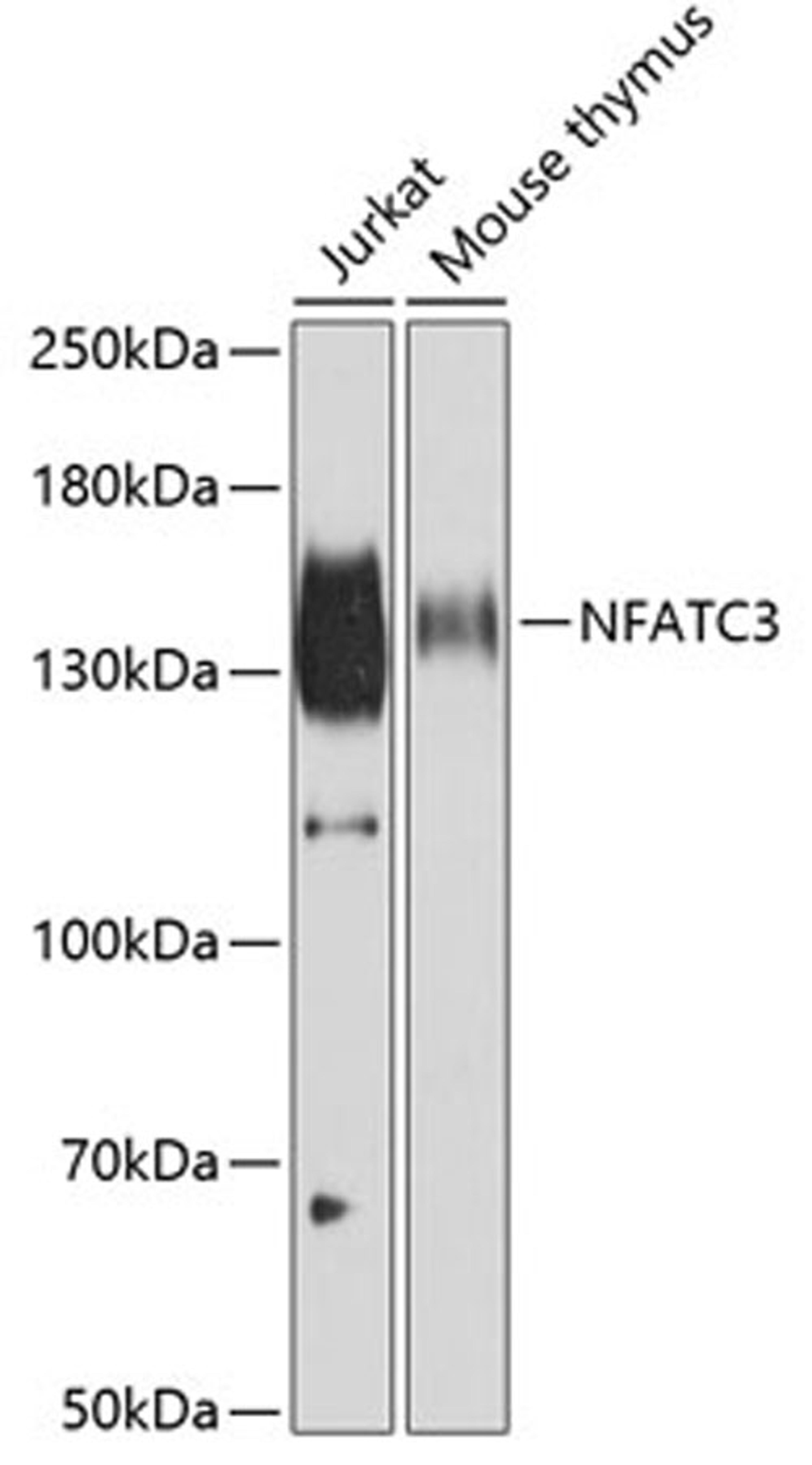 Western blot - NFATC3 antibody (A6666)