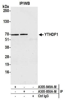 Detection of human YTHDF1 by WB of IP.