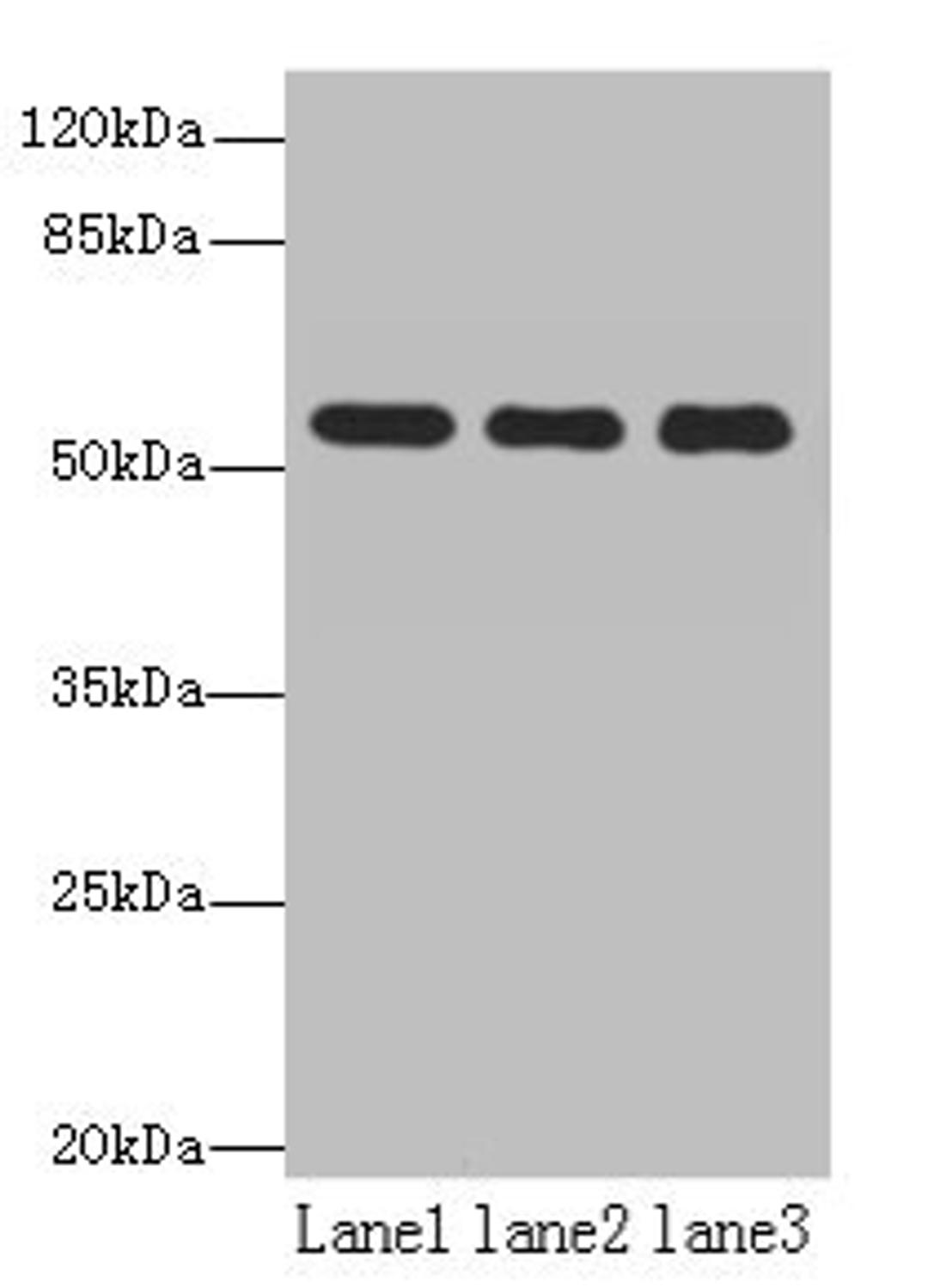 Western blot. All lanes: TBC1D22A antibody at 18µg/ml. Lane 1: Colo320 whole cell lysate. Lane 2: HepG2 whole cell lysate. Lane 3: Rat skeletal muscle tissue. Secondary. Goat polyclonal to rabbit IgG at 1/10000 dilution. Predicted band size: 60, 51, 37, 54 kDa. Observed band size: 60 kDa
