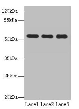 Western blot. All lanes: TBC1D22A antibody at 18µg/ml. Lane 1: Colo320 whole cell lysate. Lane 2: HepG2 whole cell lysate. Lane 3: Rat skeletal muscle tissue. Secondary. Goat polyclonal to rabbit IgG at 1/10000 dilution. Predicted band size: 60, 51, 37, 54 kDa. Observed band size: 60 kDa