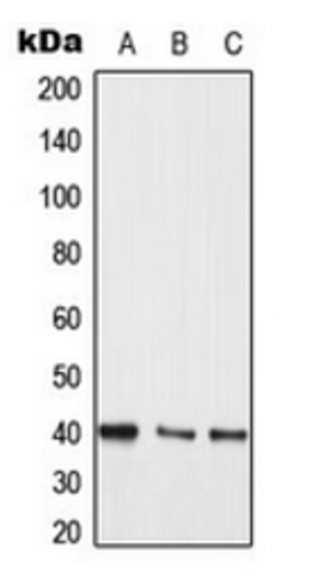 Western blot analysis of Jurkat (Lane 1), A431 (Lane 2), PC12 (Lane 3) whole cell lysates using MKK3/6 antibody