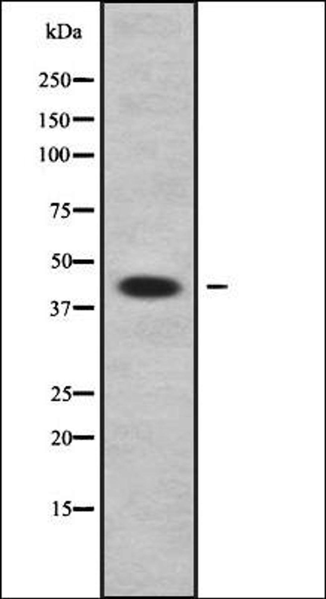 Western blot analysis of A549 whole cell lysates using APOL3 antibody