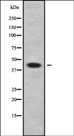 Western blot analysis of A549 whole cell lysates using APOL3 antibody