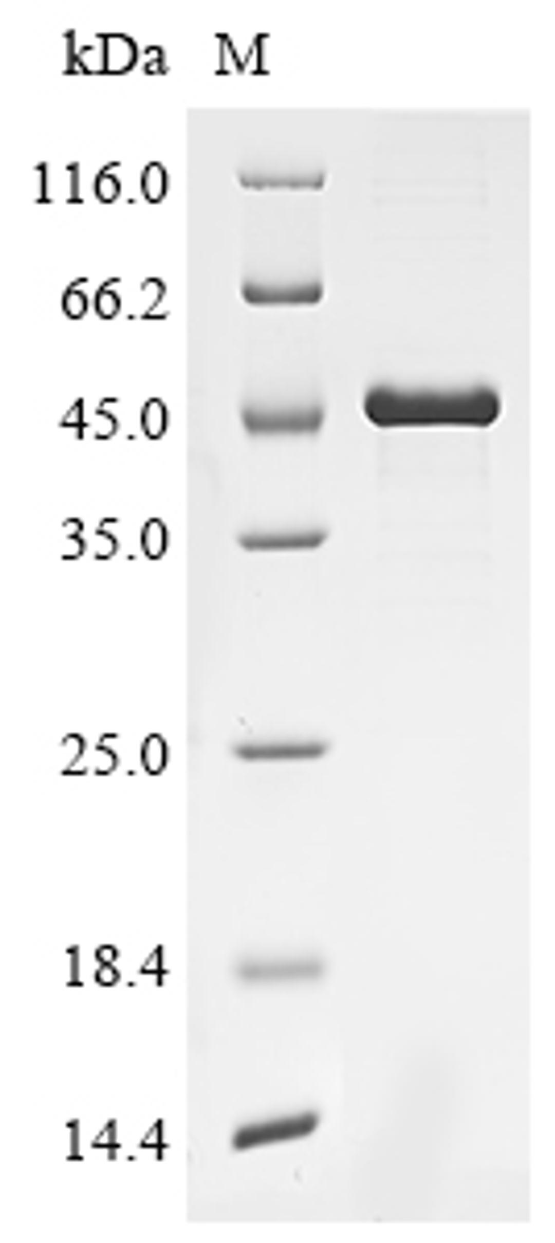 (Tris-Glycine gel) Discontinuous SDS-PAGE (reduced) with 5% enrichment gel and 15% separation gel.