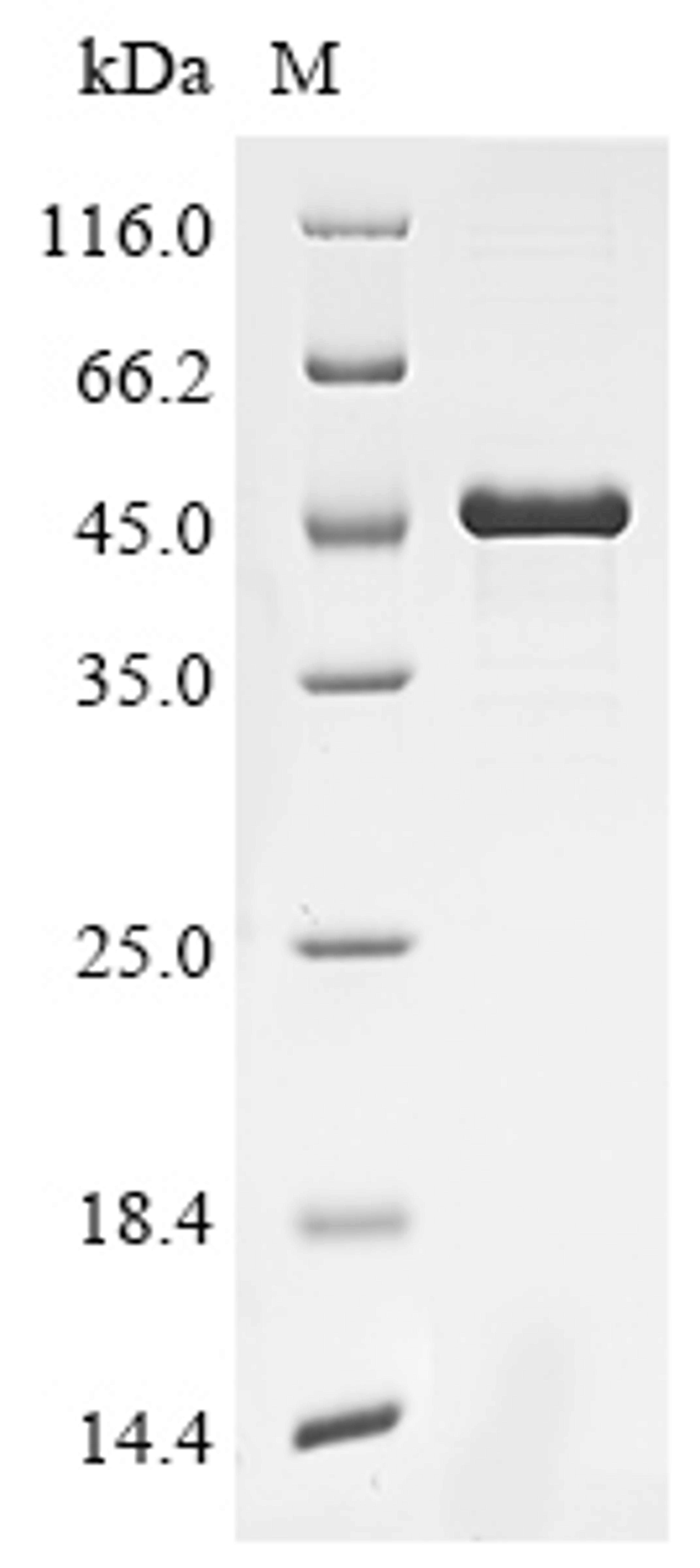 (Tris-Glycine gel) Discontinuous SDS-PAGE (reduced) with 5% enrichment gel and 15% separation gel.