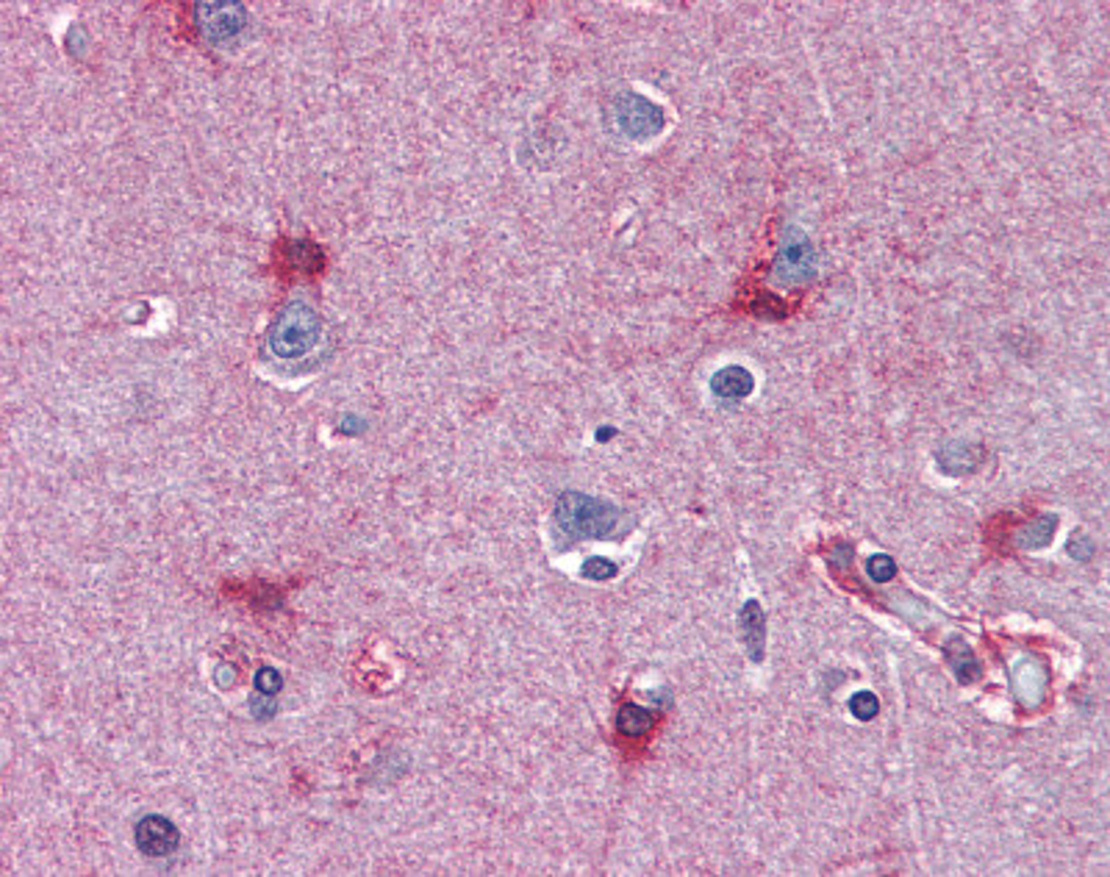 Human brain cortex tissue stained with MAT2A Antibody at 10 μg/mL followed by biotinylated anti-mouse IgG secondary antibody, alkaline phosphatase-streptavidin and chromogen.