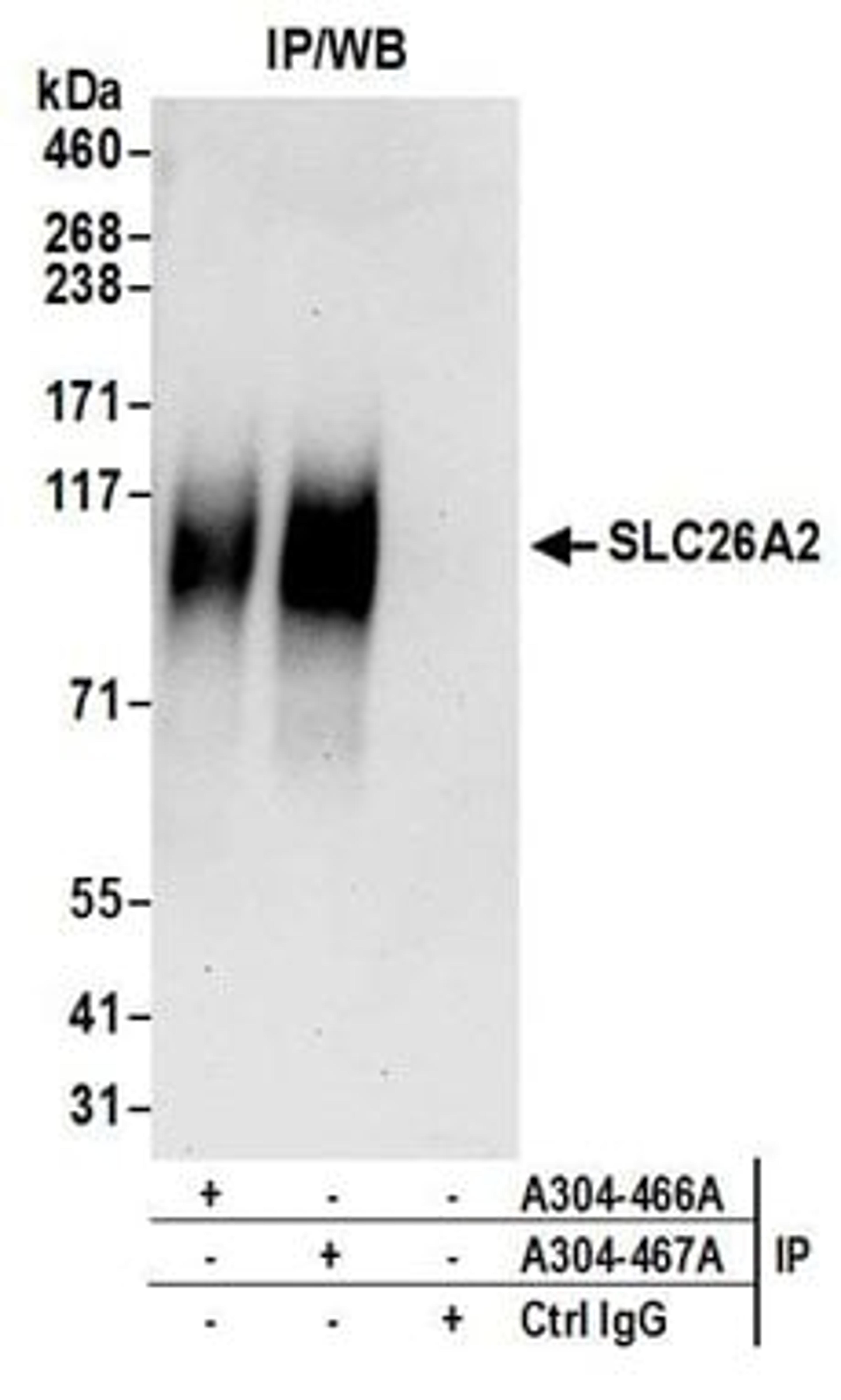 Detection of human SLC26A2 by western blot of immunoprecipitates.