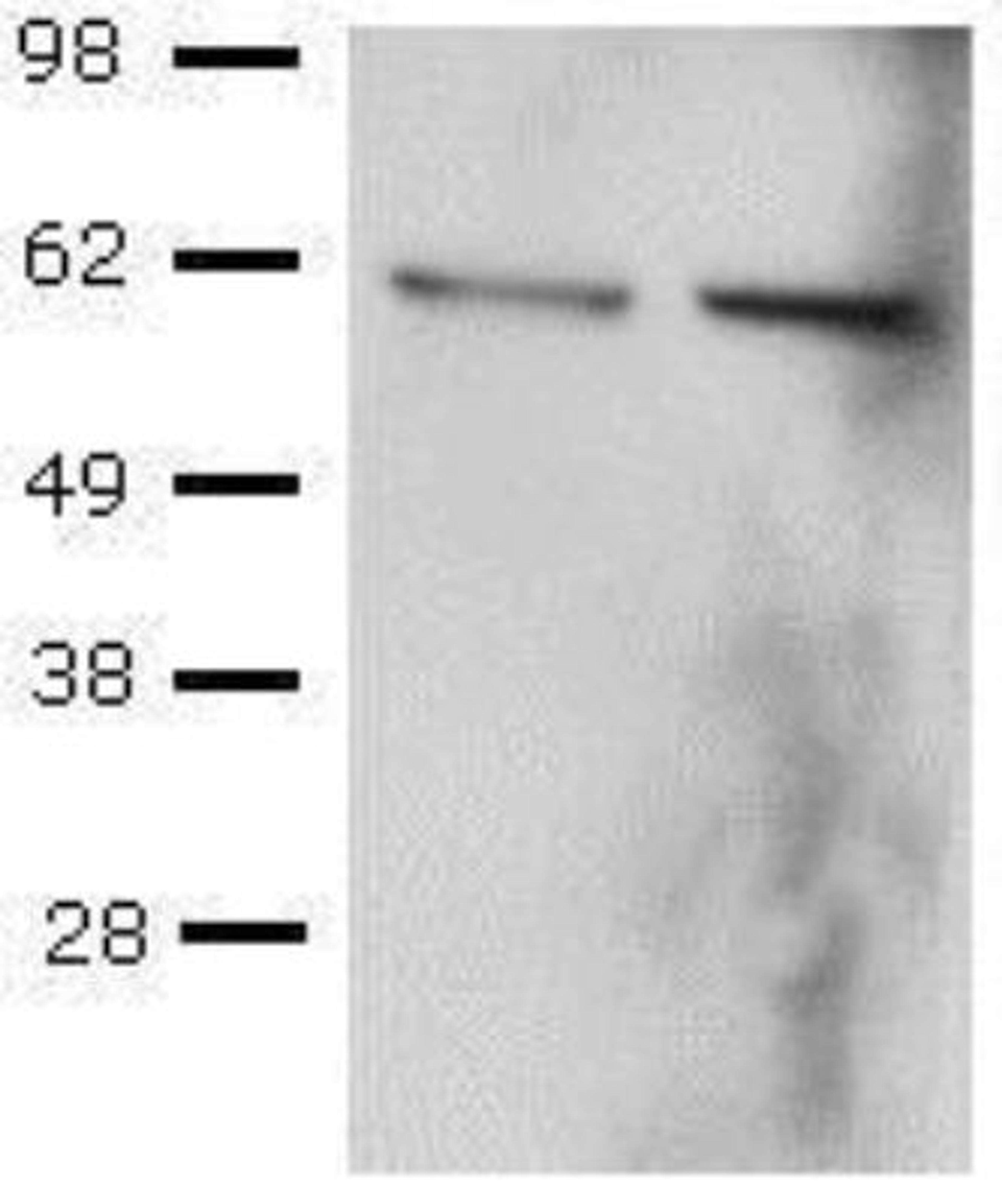 Western Blot: T-bet/TBX21 Antibody (39D) [NBP1-43299] - CD4+ T cells were sorted from mouse splenocytes, then activated with Anti-Mouse CD3 and Anti-Mouse CD28, followed by culture in Th1-polarizing conditions, and re-stimulation with PMA and Ionomycin. Lysates from control (left) or PMA and Ionomycin-re-stimulated (right) cells were probed with Anti-T-bet Purified at 2 ug/ml, and revealed with Anti-Mouse IgG HRP.