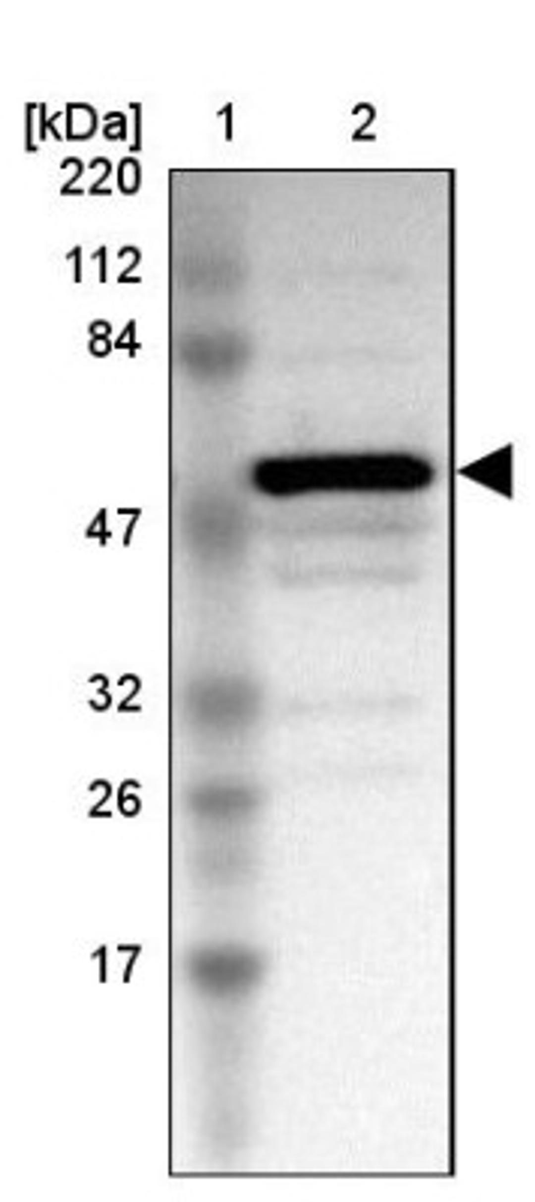 Western Blot: Trim22 Antibody [NBP1-81795] - Lane 1: Marker [kDa] 220, 112, 84, 47, 32, 26, 17<br/>Lane 2: Human cell line RT-4