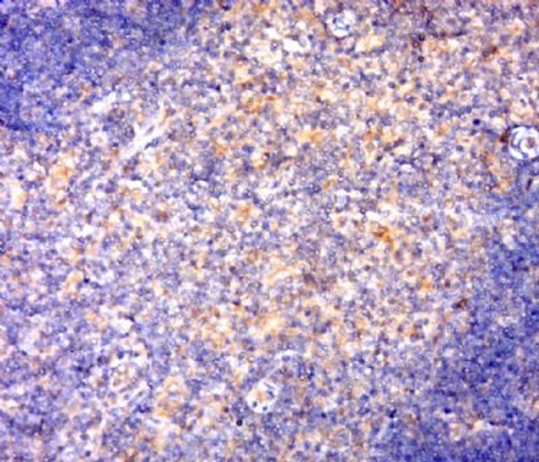 Immunohistochemical staining of mouse thymus tissue using NFKB2(phospho-Ser866+Ser870) antibody.