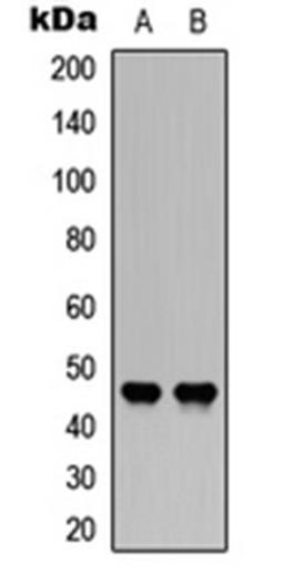 Western blot analysis of human kidney (Lane1), human brain (Lane2) whole cell using CD142 (phospho-S290) antibody