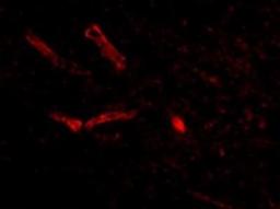 Immunocytochemistry/Immunofluorescence: Syntaphilin Antibody [NBP1-76915] - Human Brain cells.