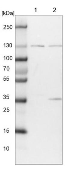 Western Blot: O-GlcNAcase/OGA/MGEA5 Antibody [NBP1-81244] - Lane 1: NIH-3T3 cell lysate (Mouse embryonic fibroblast cells)<br/>Lane 2: NBT-II cell lysate (Rat Wistar bladder tumour cells)