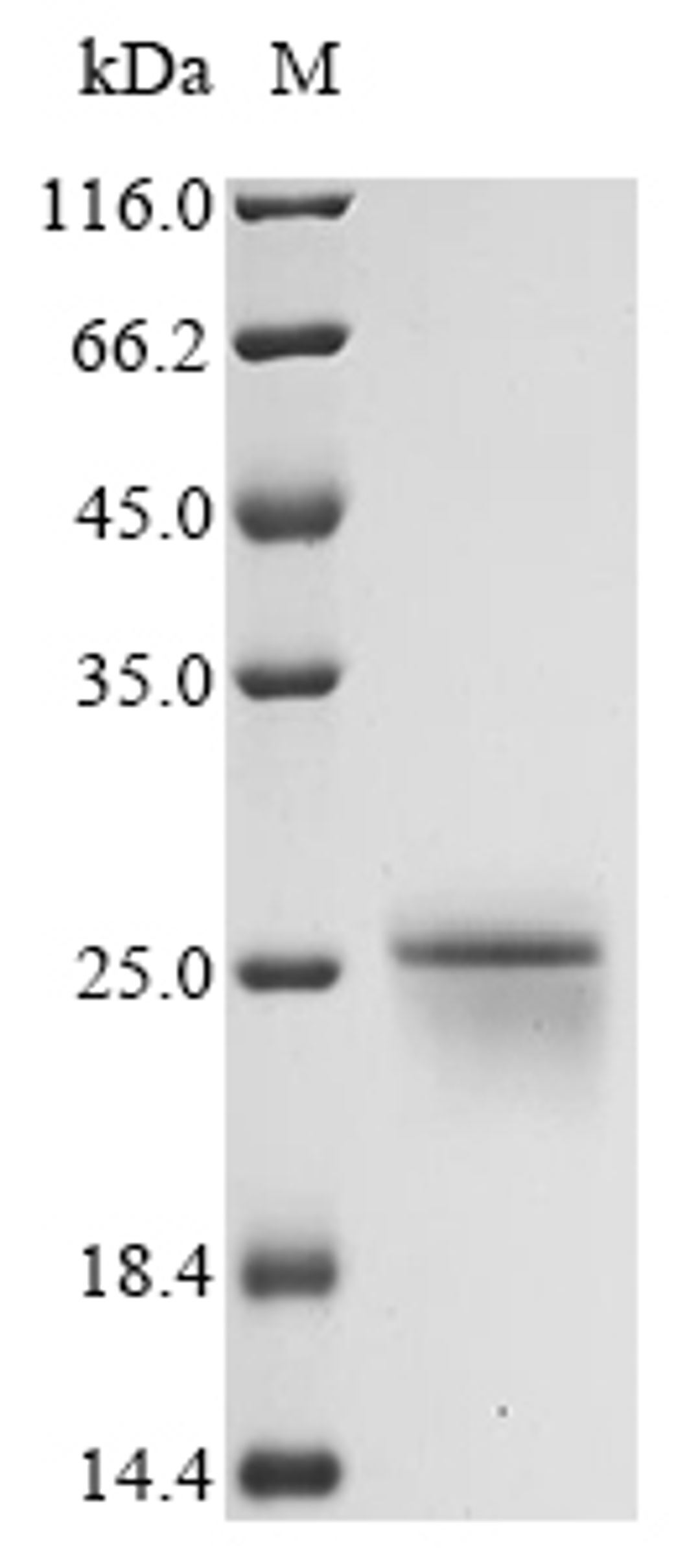 (Tris-Glycine gel) Discontinuous SDS-PAGE (reduced) with 5% enrichment gel and 15% separation gel.