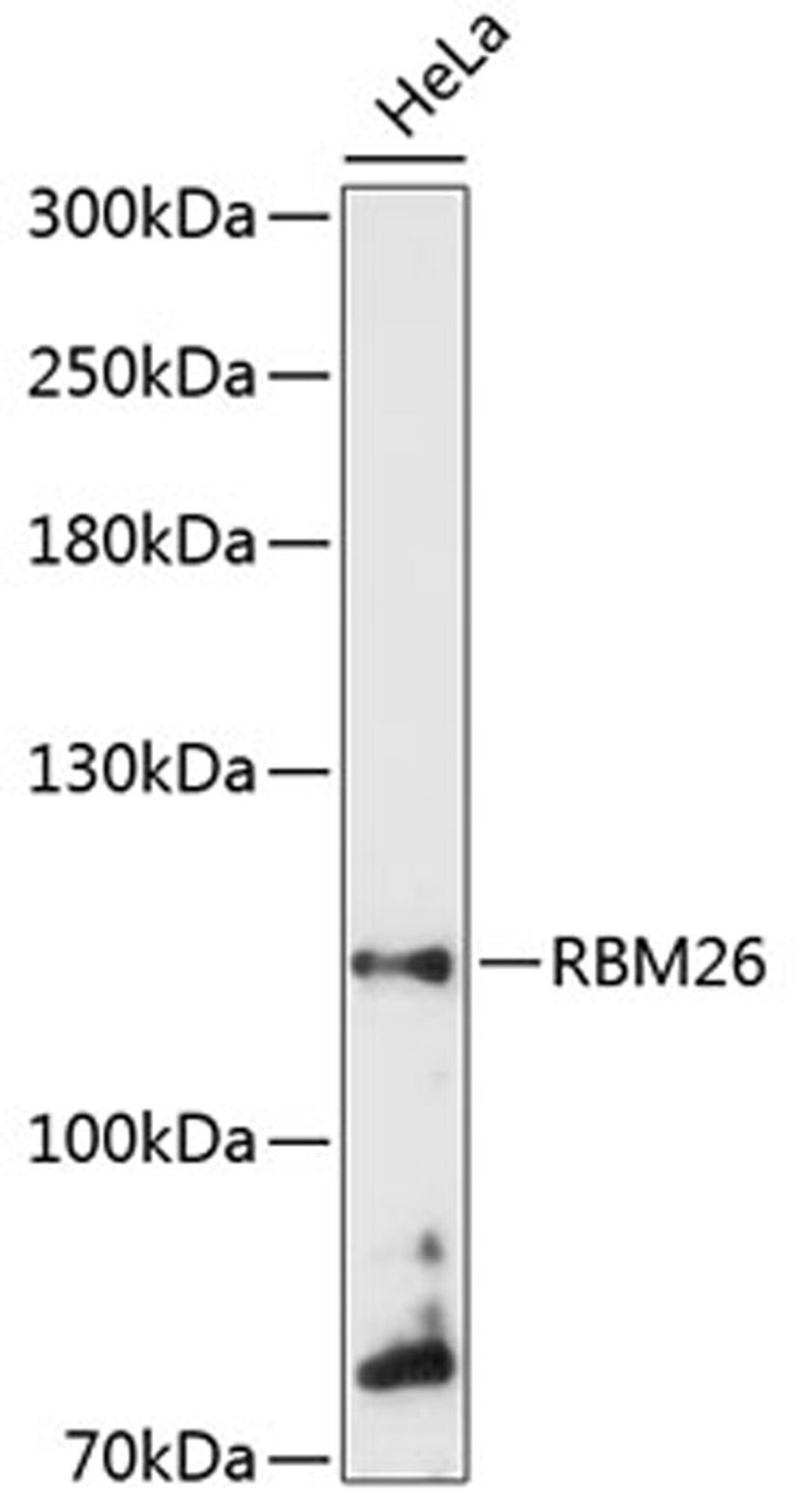 Western blot - RBM26 antibody (A13119)