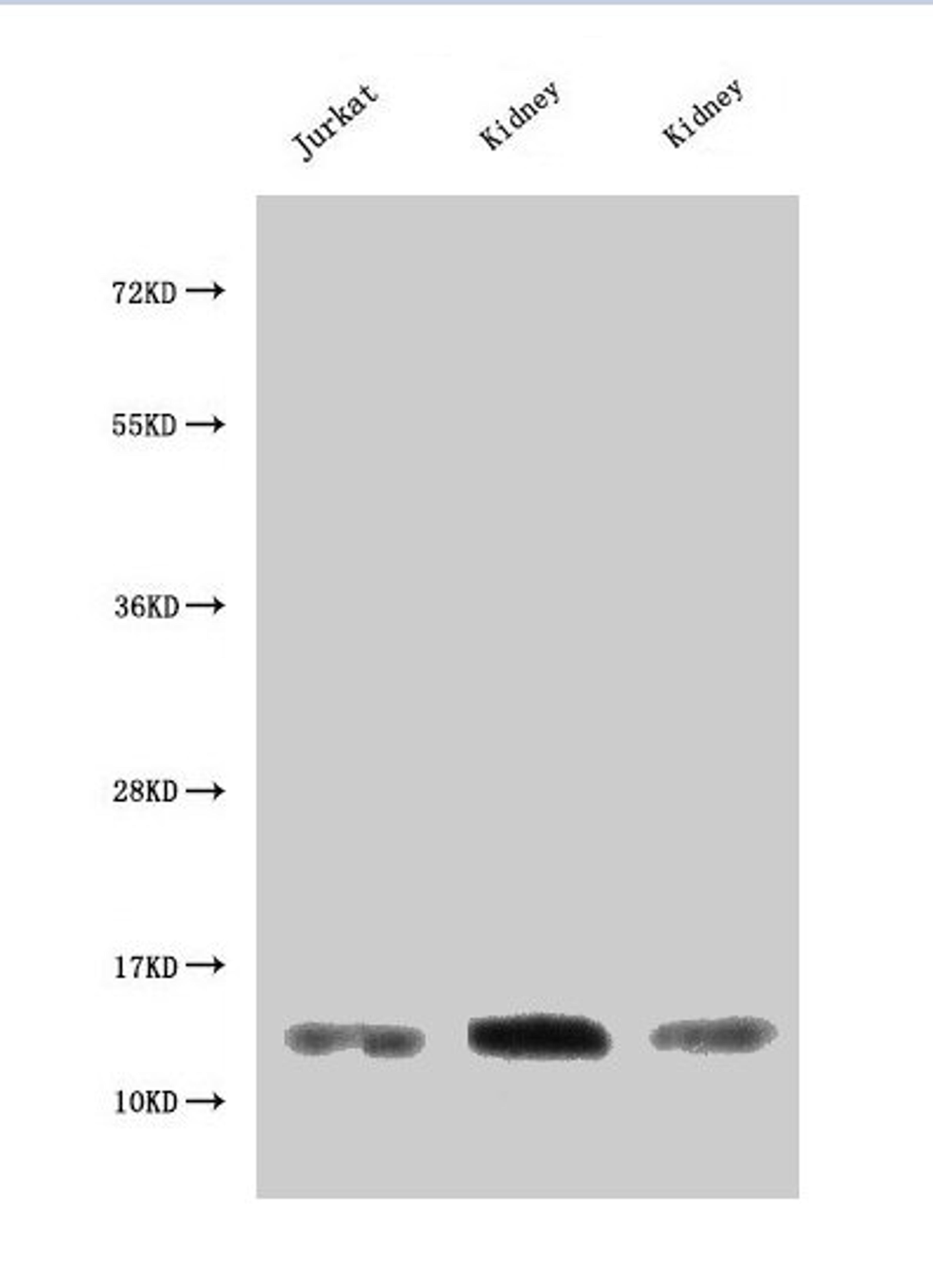 Western Blot. Positive WB detected in: Jurkat whole cell lysate, Rat kidney tissue, Mouse kidney tissue. All lanes: MIF antibody at 3µg/ml. Secondary. Goat polyclonal to rabbit IgG at 1/50000 dilution. Predicted band size: 13 kDa. Observed band size: 13 kDa