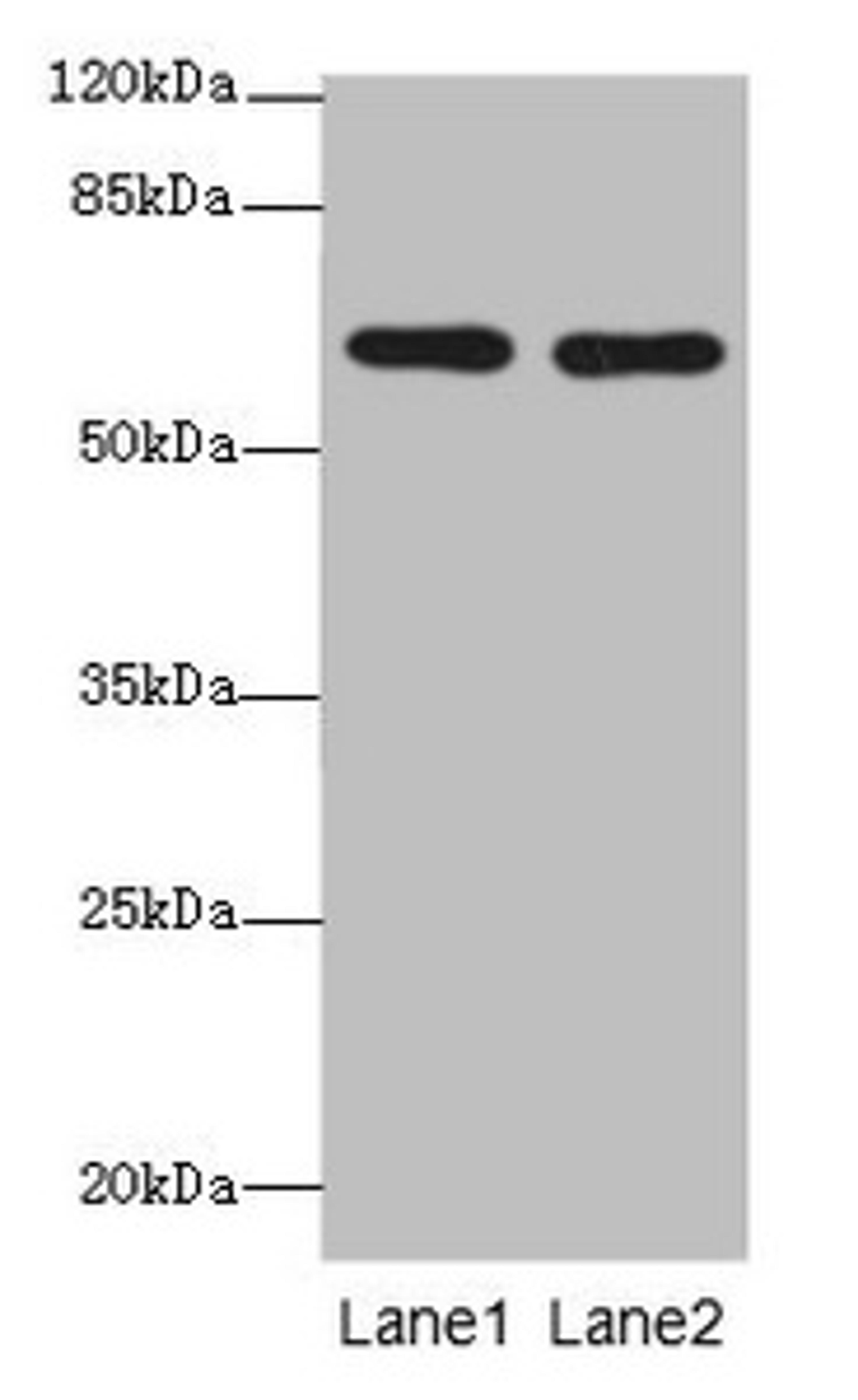 Western blot. All lanes: CNOT2 antibody at 2µg/ml. Lane 1: 293T whole cell lysate. Lane 2: Jurkat whole cell lysate. Secondary. Goat polyclonal to rabbit IgG at 1/10000 dilution. Predicted band size: 60, 41, 23, 52, 55 kDa. Observed band size: 60 kDa