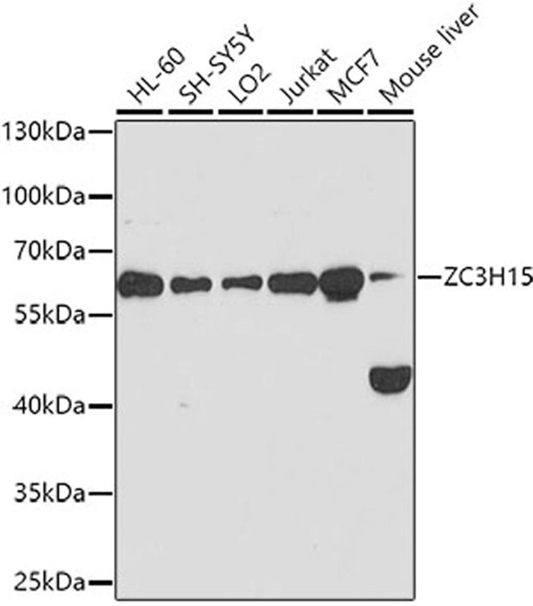 Western blot - ZC3H15 antibody (A10045)