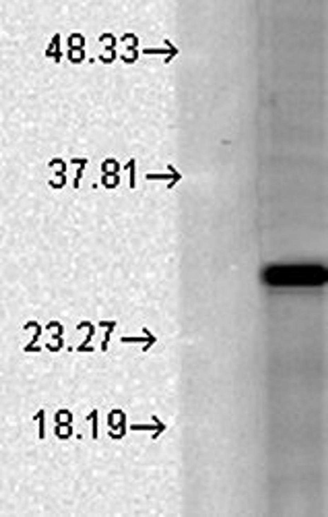 Western blot analysis of human cell line lysate using BK Beta2 antibody