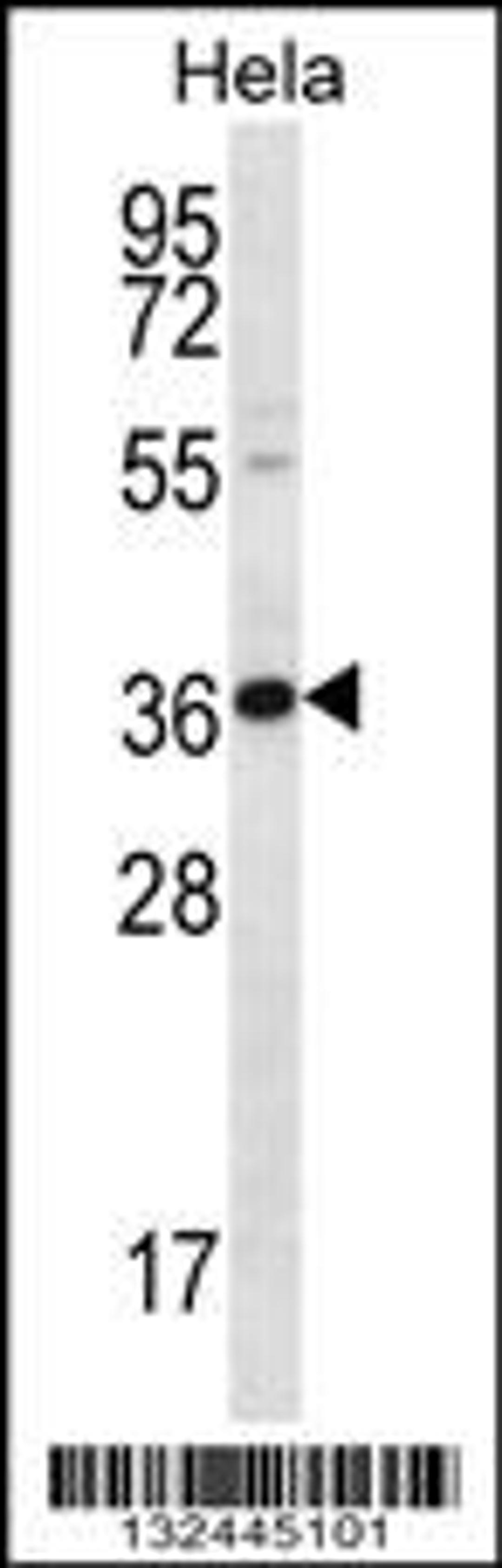 Western blot analysis in Hela cell line lysates (35ug/lane).