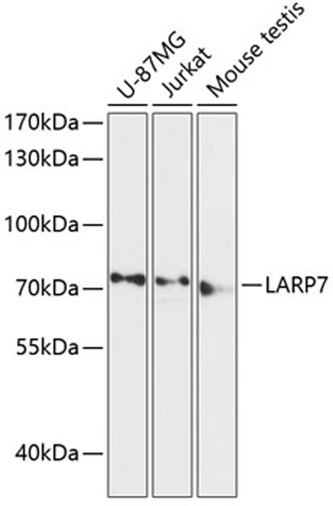 Western blot - LARP7 antibody (A13095)