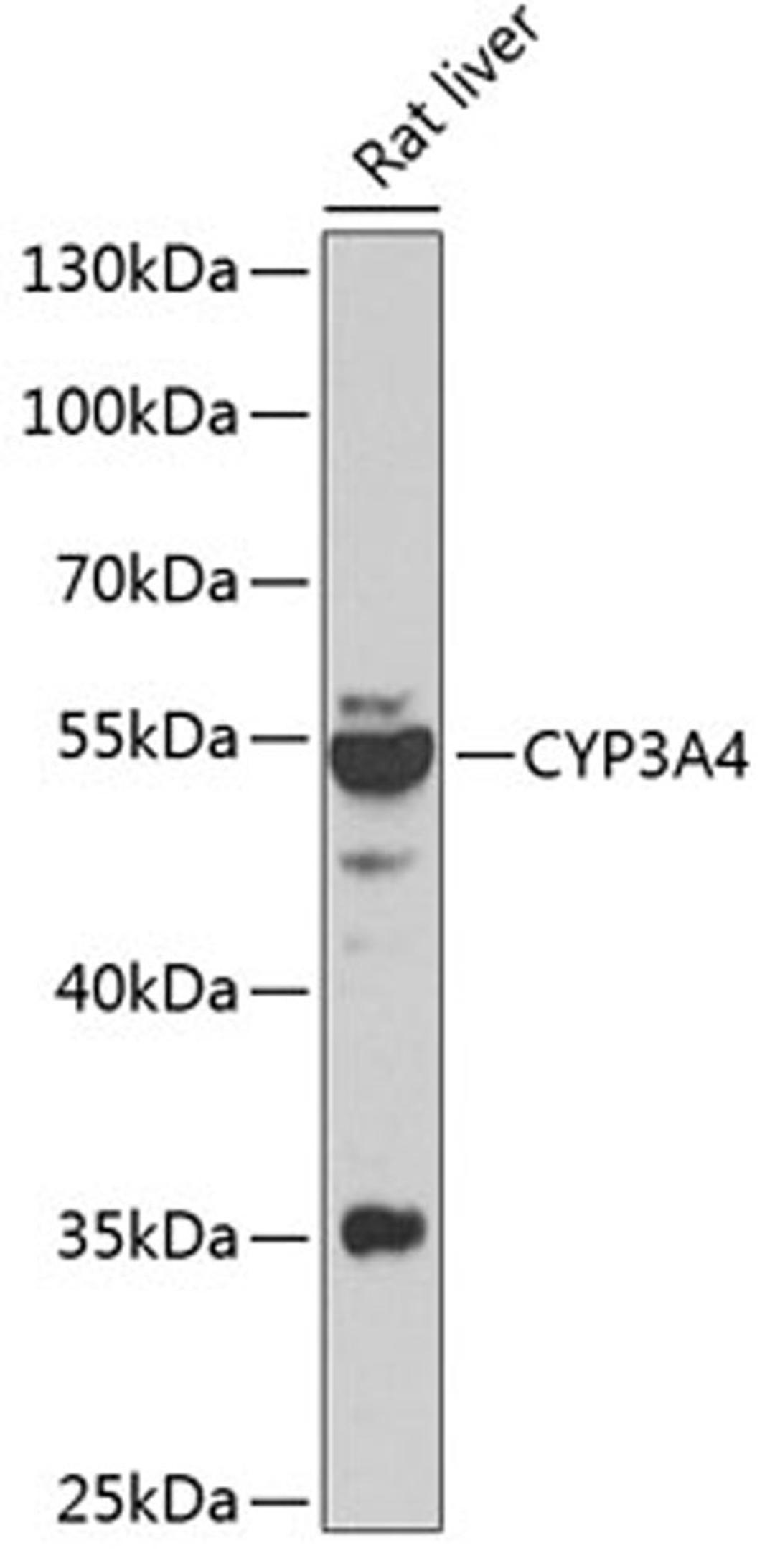 Western blot - CYP3A4 antibody (A13483)