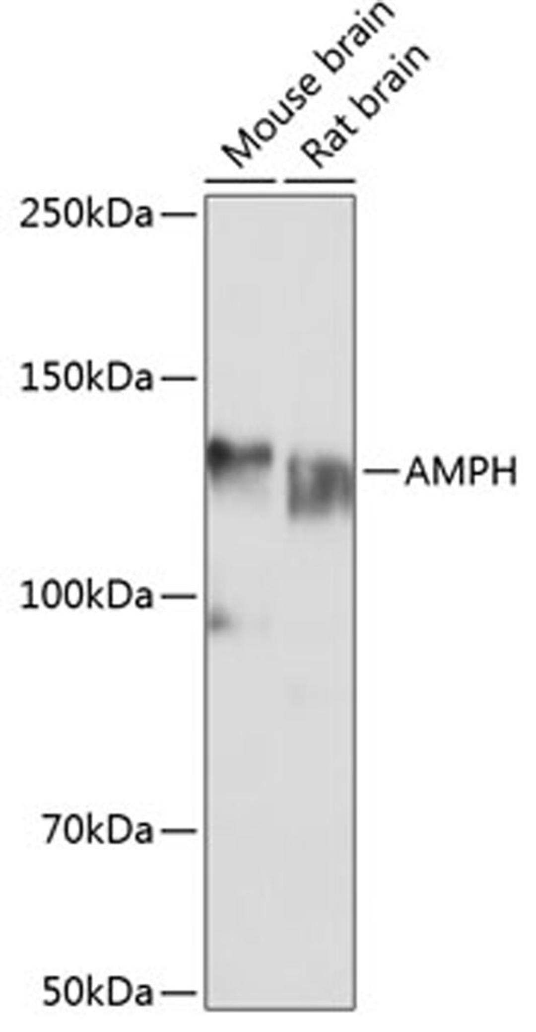 Western blot - AMPH Polyclonal Antibody (A5389)