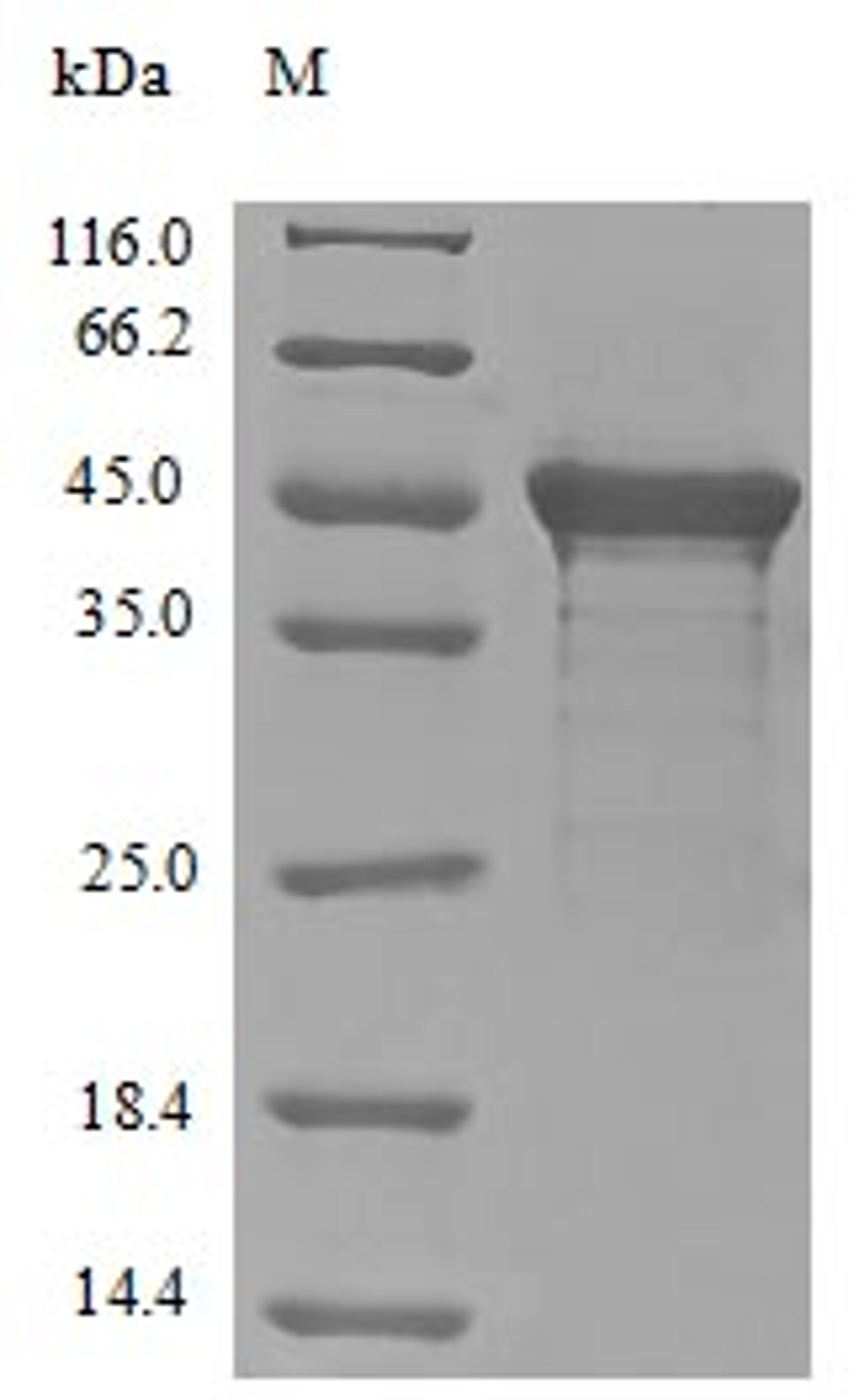 (Tris-Glycine gel) Discontinuous SDS-PAGE (reduced) with 5% enrichment gel and 15% separation gel.