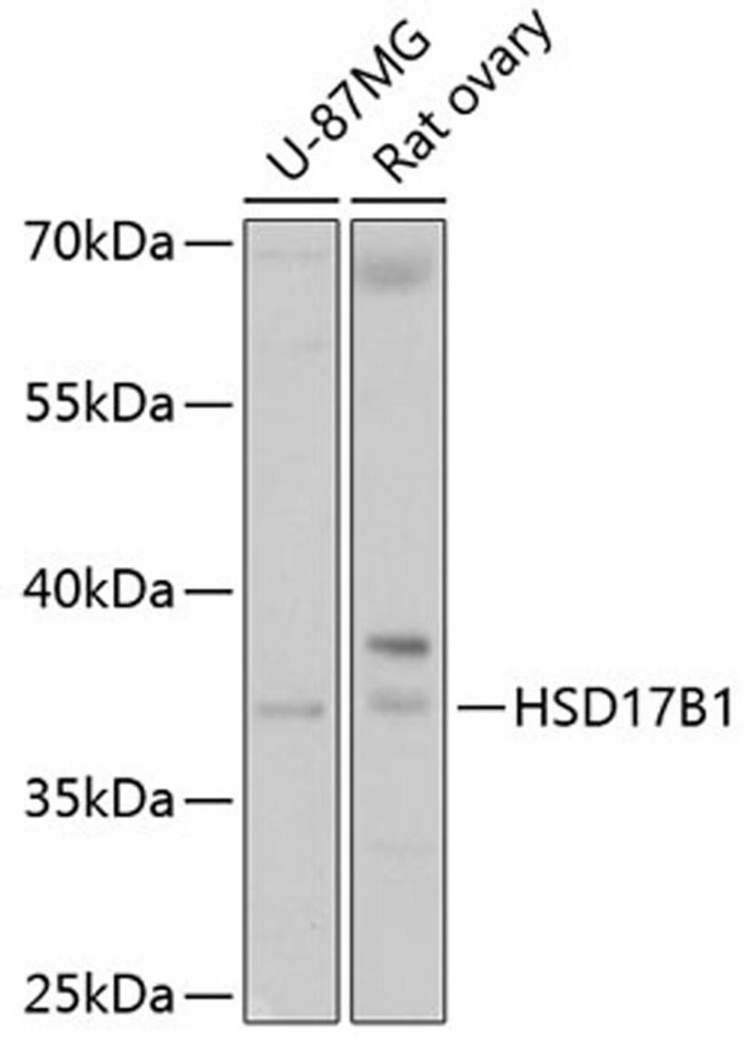 Western blot - HSD17B1 antibody (A10839)