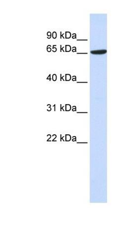 Western Blot: ADAM9 Antibody [NBP1-59010] - 293T cells lysate, concentration 0.2-1 ug/ml.