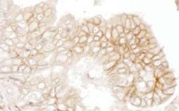 Detection of human CD147 by immunohistochemistry.