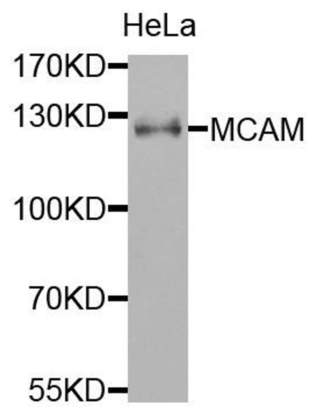 Western blot analysis of extracts of HeLa cells using MCAM antibody