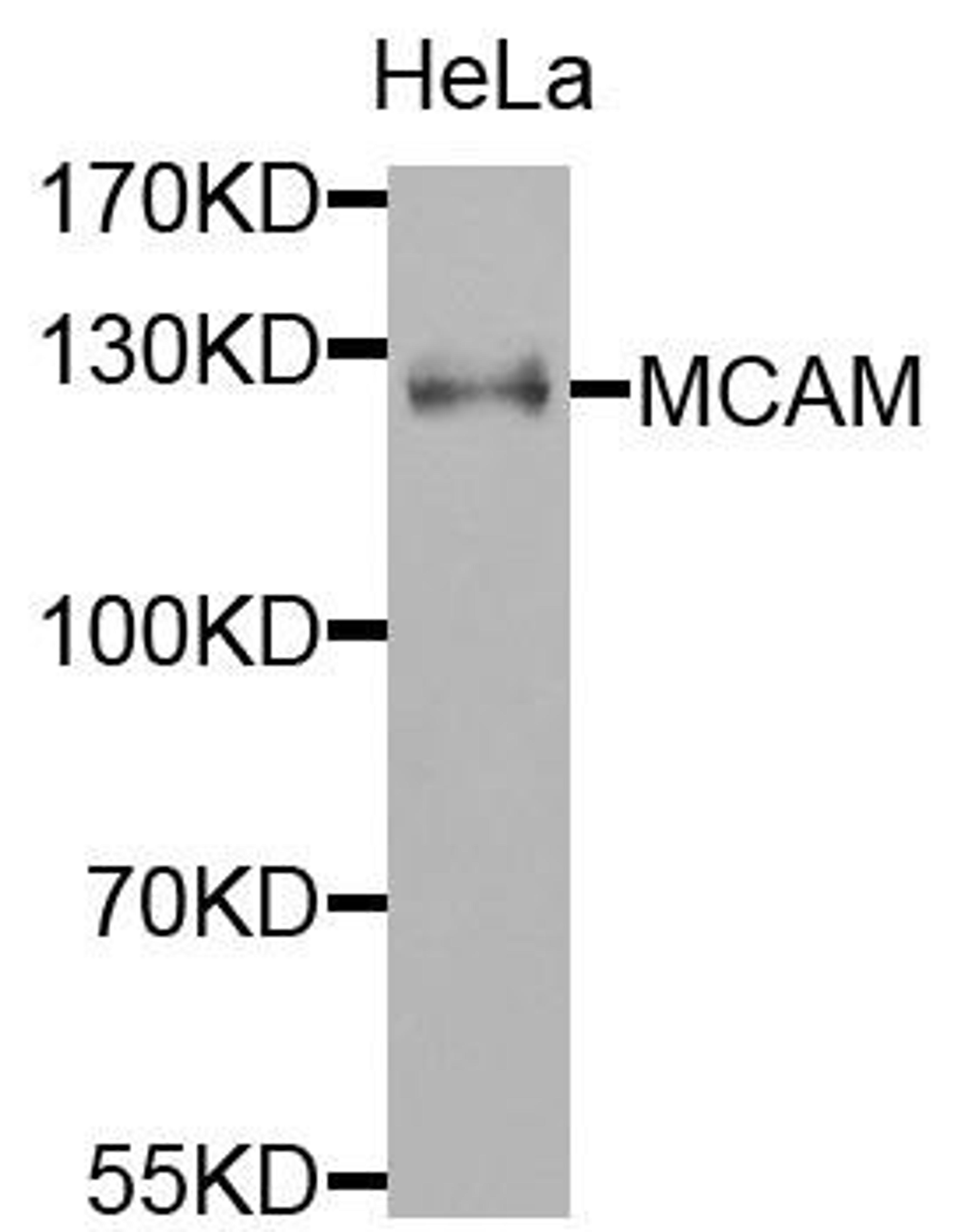 Western blot analysis of extracts of HeLa cells using MCAM antibody