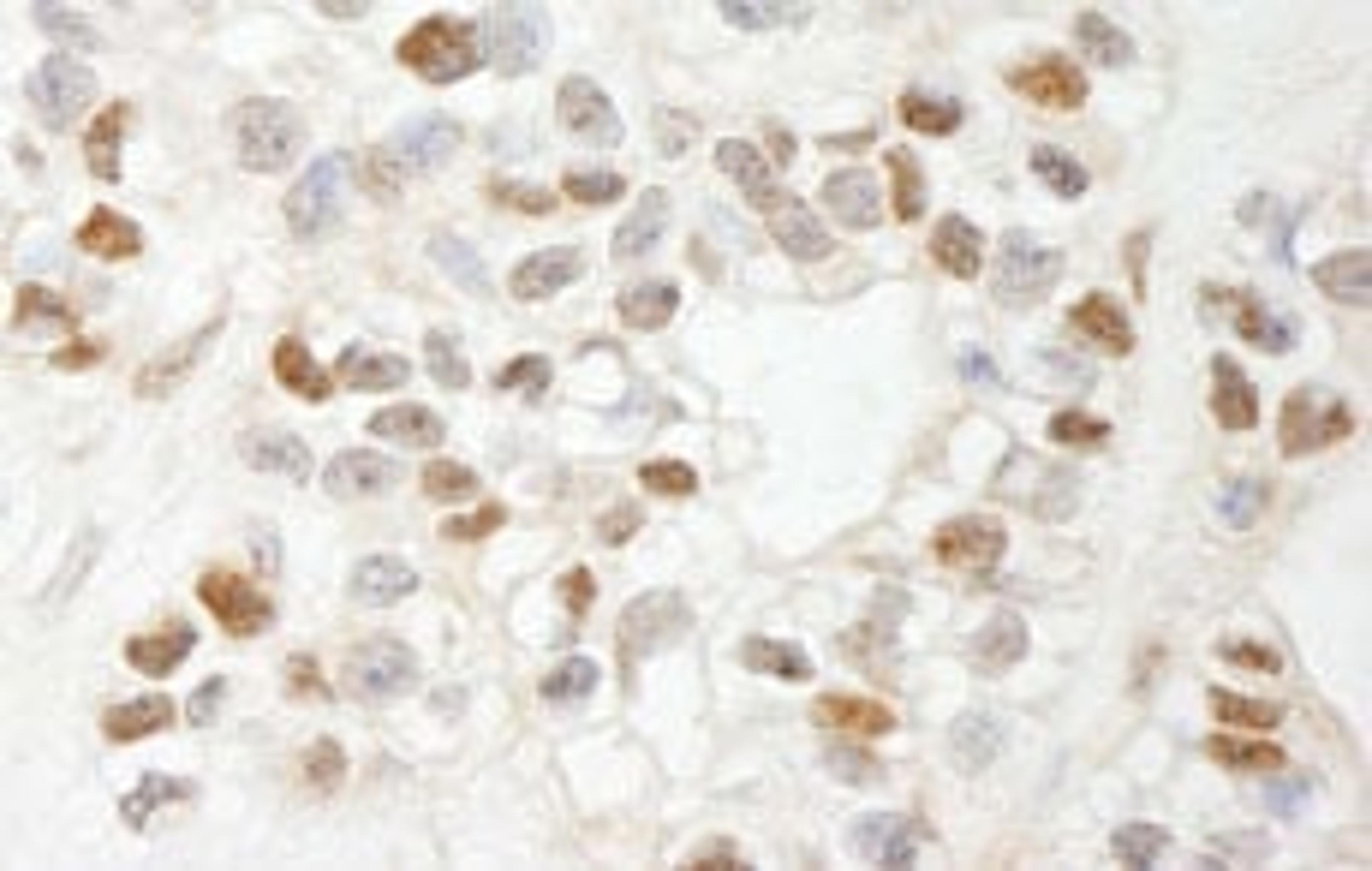 Detection of human MCAF by immunohistochemistry.