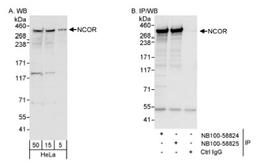 Western Blot: NCOR Antibody [NB100-58824] - Detection of Human NCOR on HeLa whole cell lysate using NB100-5882. NCOR was also immunoprecipitated by rabbit anti-NCOR antibody NB100-58825.