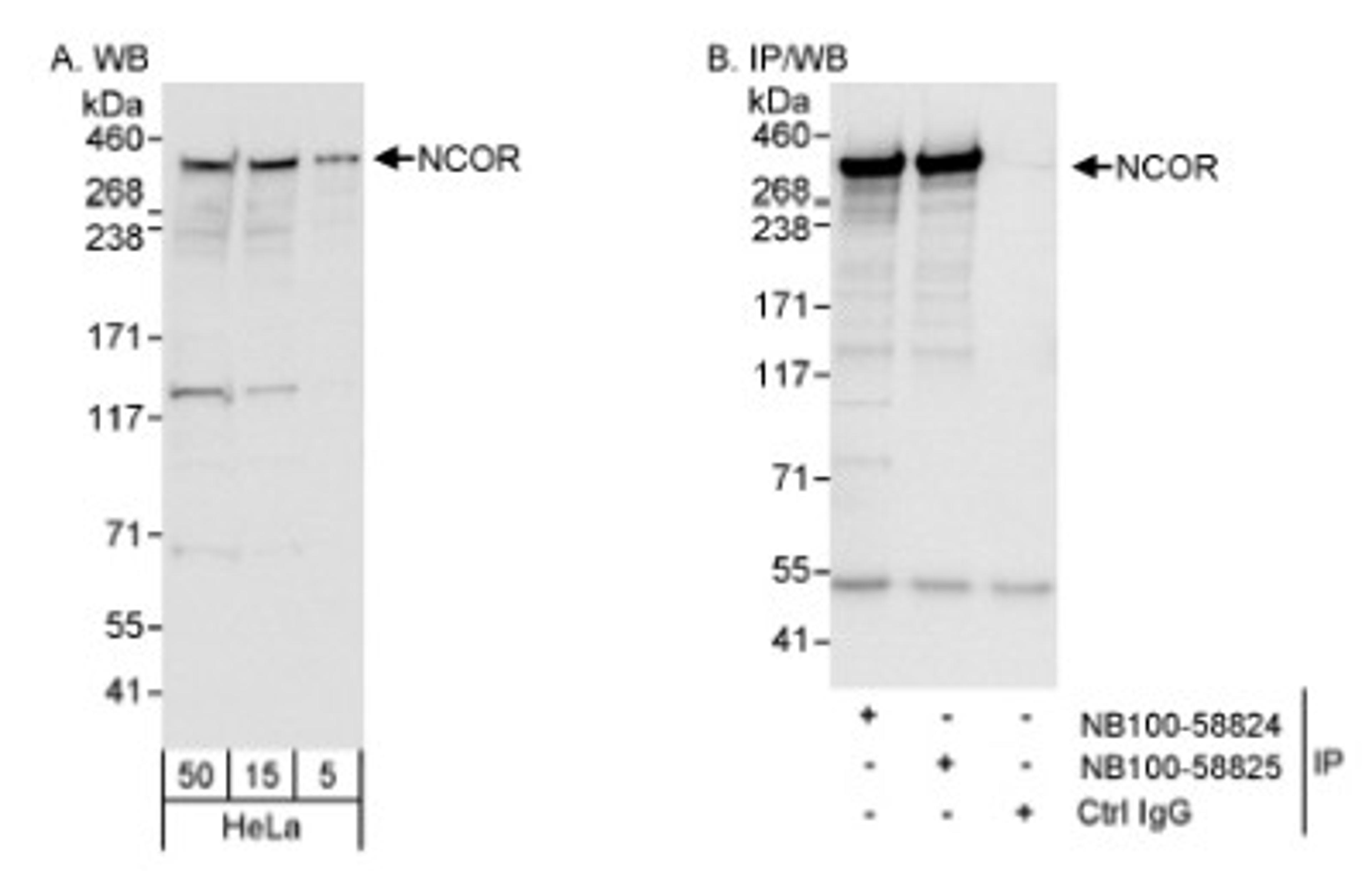 Western Blot: NCOR Antibody [NB100-58824] - Detection of Human NCOR on HeLa whole cell lysate using NB100-5882. NCOR was also immunoprecipitated by rabbit anti-NCOR antibody NB100-58825.