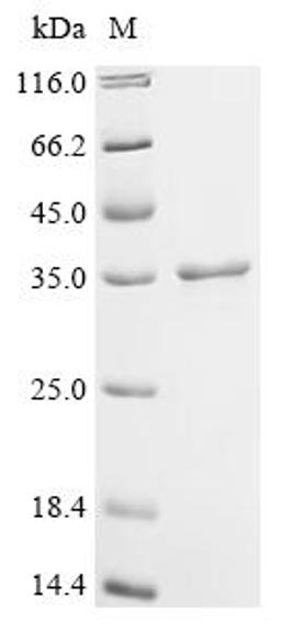 (Tris-Glycine gel) Discontinuous SDS-PAGE (reduced) with 5% enrichment gel and 15% separation gel.